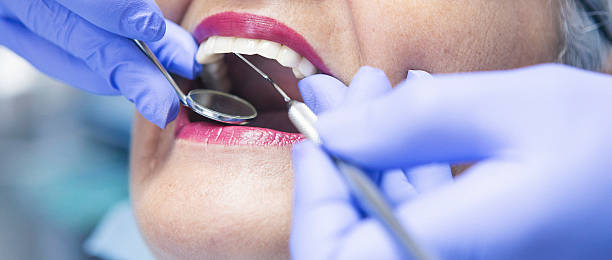 Best Broken or Cracked Tooth Emergency Dentist in Wye, MT